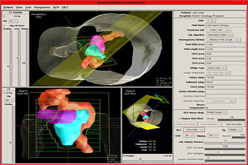 radiation treatment planning system